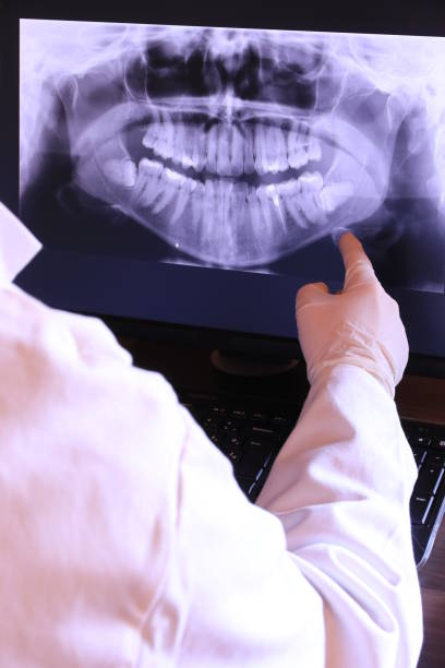 Best Emergency Dental Extractions in Park City, TN
