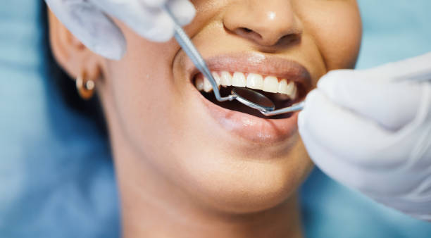 Best Emergency Dental Extractions in Park City, TN